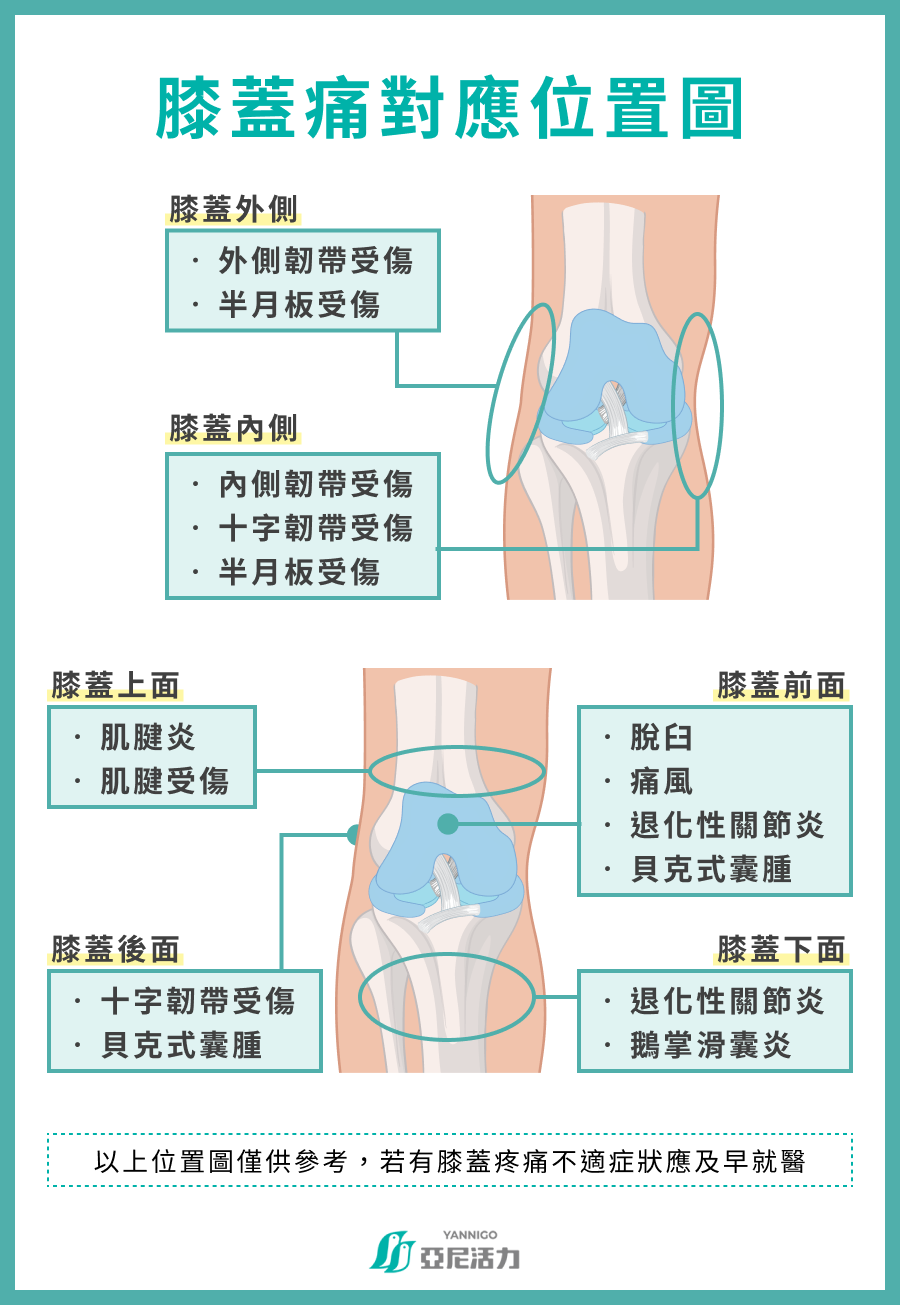 膝蓋痛對應位置圖